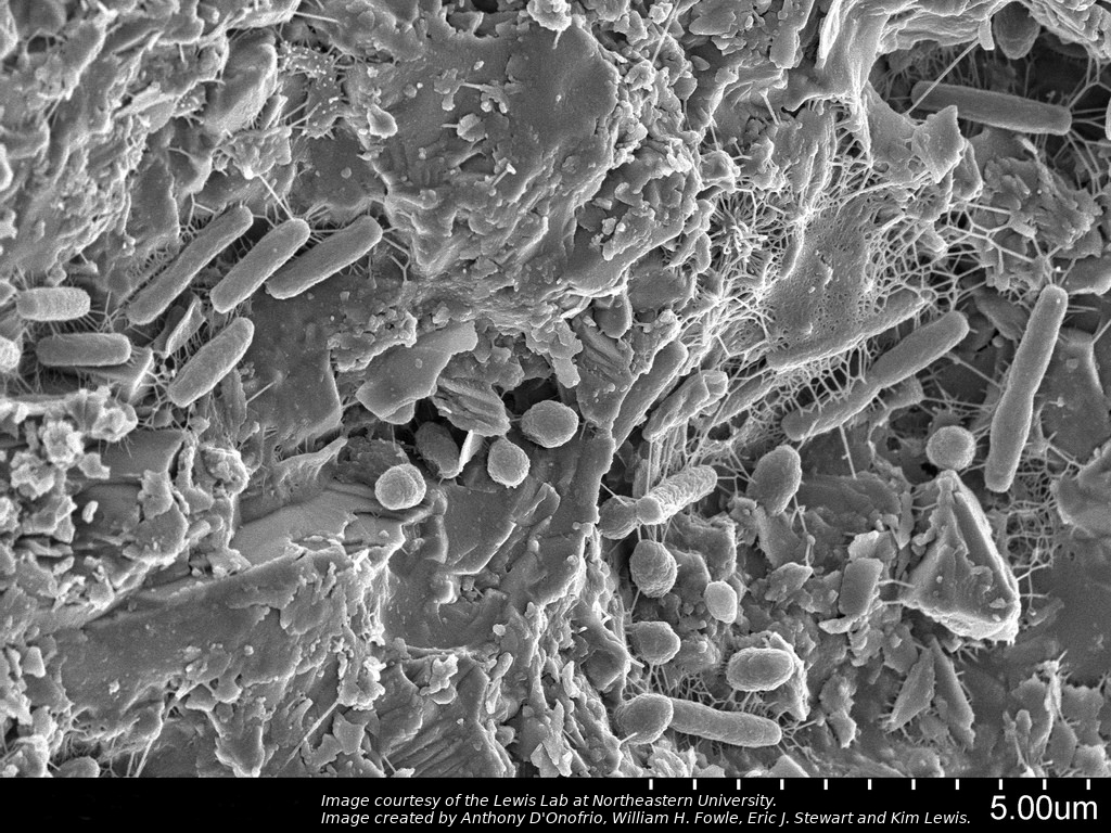 An image of microbes on a grain of sand.