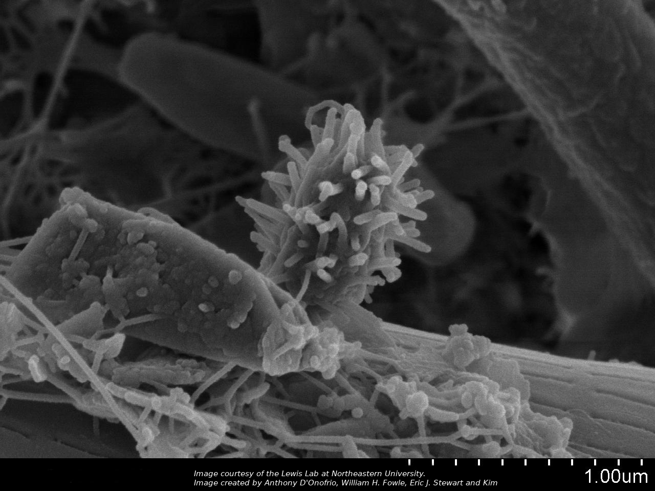 An image of a spiky microbe on a grain of sand.