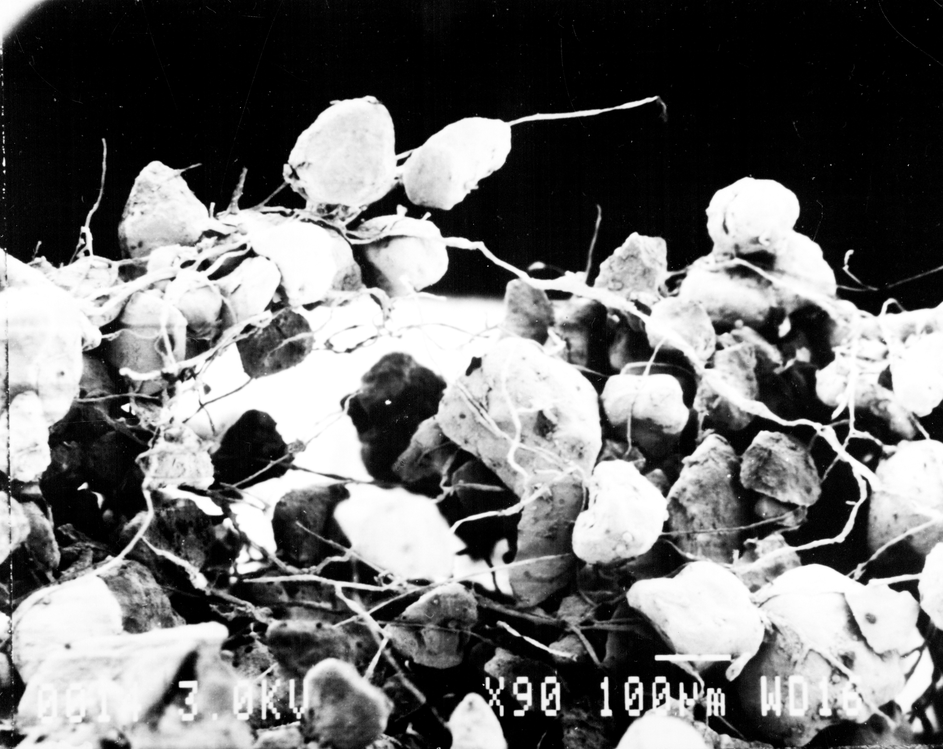 A microscopic image of Cyanobacteria wrapped around sand grains.