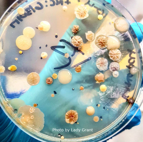 ​A petri dish covered with a wide variety of microbial cultures, held by a gloved hand.