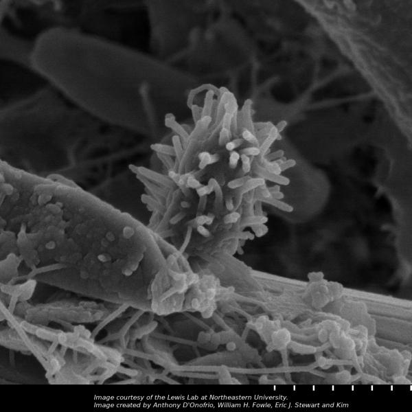 An image of a spiky microbe on a grain of sand.